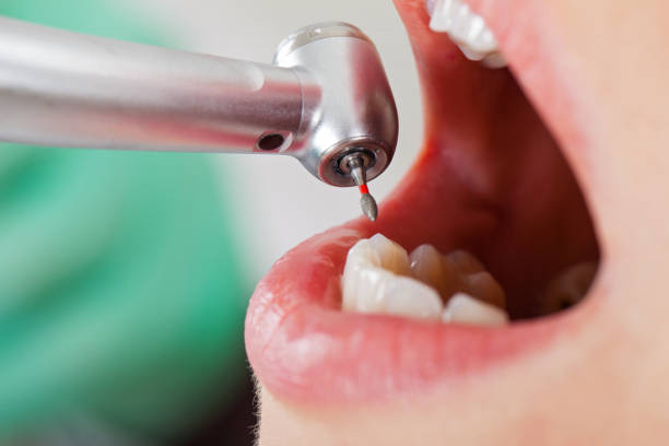 Best Emergency Treatment for Dental Infections or Abscesses in Palos Hls, IL